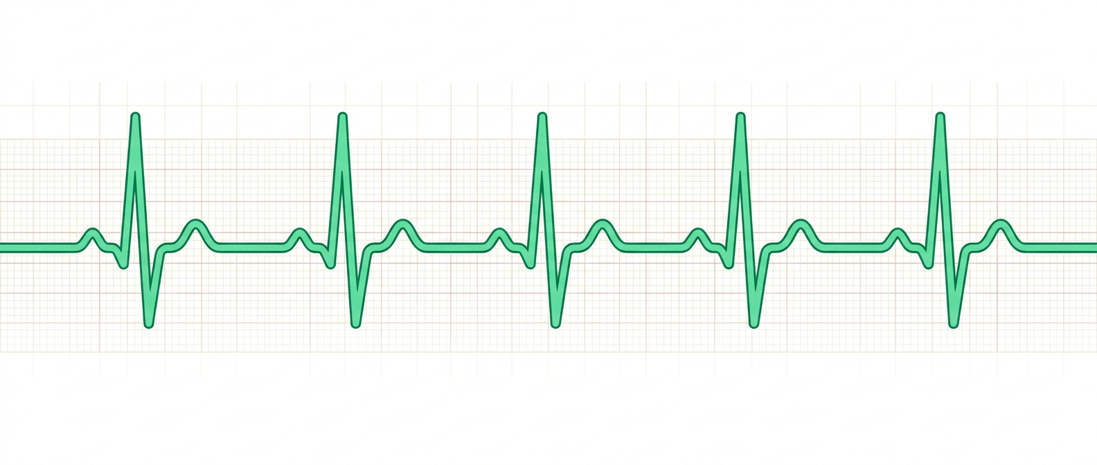EKG schreiben: Anleitung für die MFA